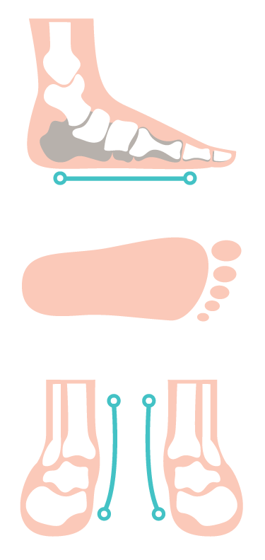 THE FLAT FOOT